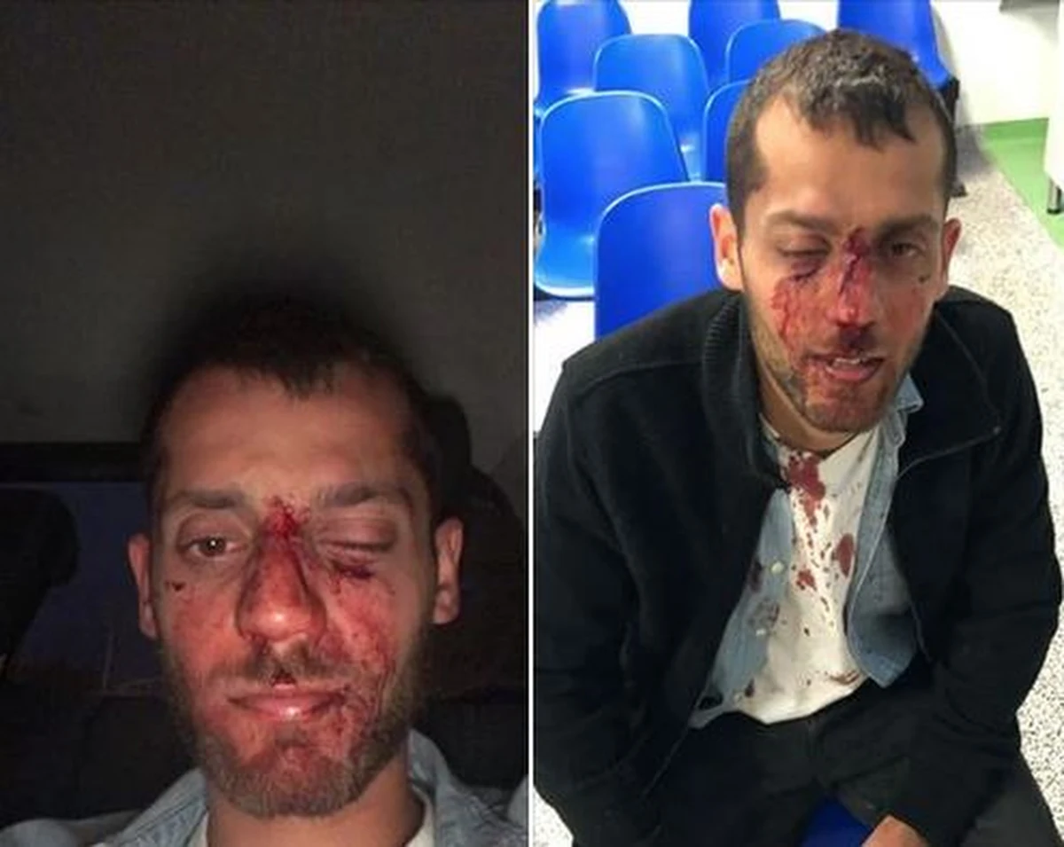 W poniedziałek ma zostać wszczęte śledztwo w sprawie pobicia izraelskich studentów w centrum Warszawy. Do zdarzenia doszło w sobotę nad ranem przed jednym z klubów. 
