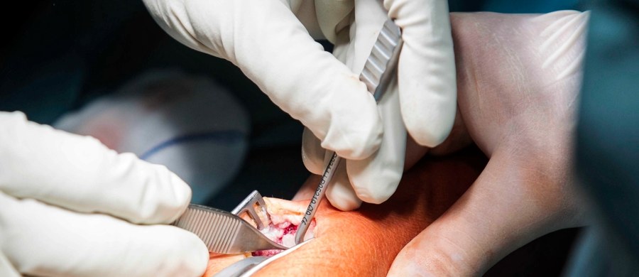 W Uniwersyteckim Szpitalu Klinicznym we Wrocławiu pacjentce cierpiącej na zwyrodnienie stawu wszczepiono nowoczesną, dwumobilną protezę w kciuku. Dzięki zabiegowi kobieta przez kilkanaście lat będzie mogła swobodnie i bez bólu poruszać tym palcem.