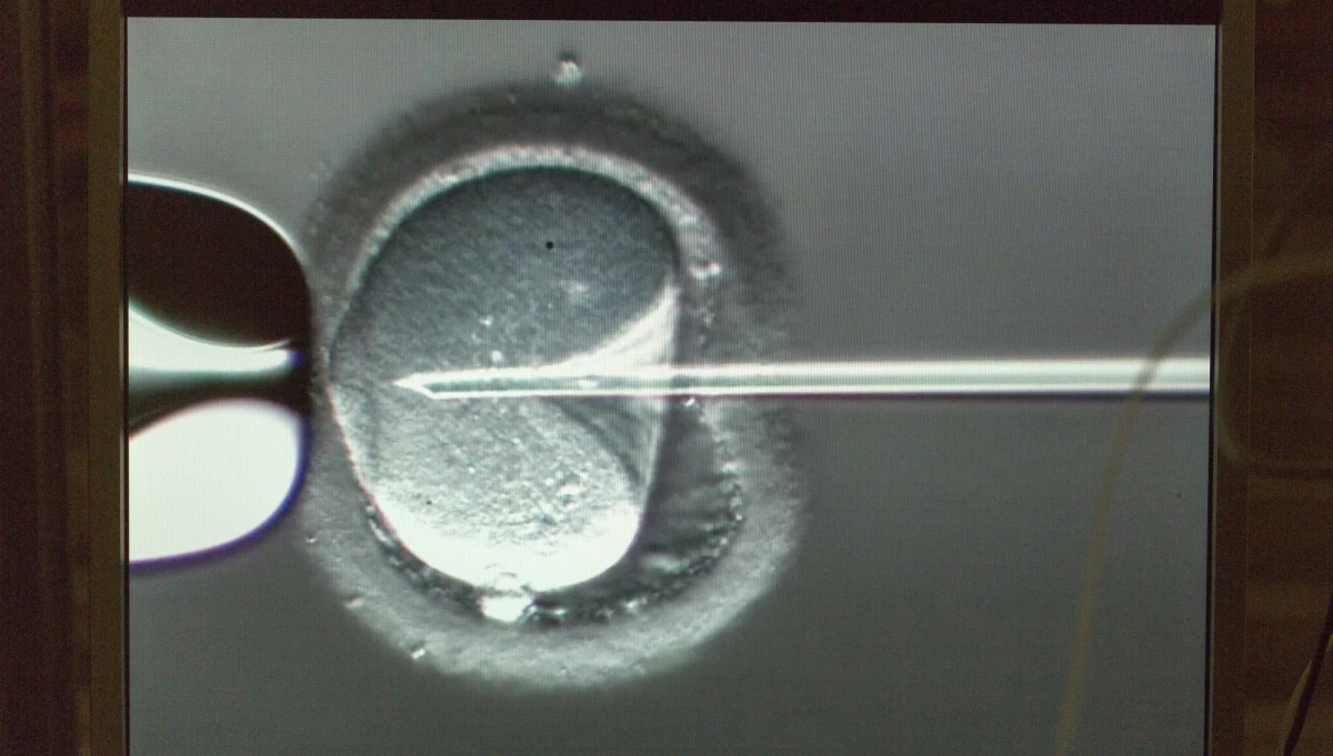 Amerykański lekarz pozwał swoją szkołę medyczną po tym, jak odkrył, że próbki jego nasienia, które przekazał uczelnianej klinice, zostały wielokrotnie wykorzystane. Mężczyzna dowiedział się, że jest ojcem co najmniej 17 dzieci.
