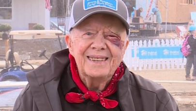Były prezydent USA Jimmy Carter trafił do szpitala 