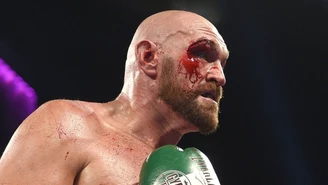 Tyson Fury znalazł winnego. "Jesteś małym, półciężkim tchórzem"