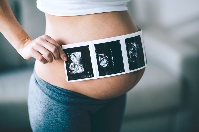 Przypadek 32-letniej kobiety z Alabamy z pewnością trafi do podręczników medycyny. Kobieta nie tylko urodziła się z dwiema macicami, ale i obecnie w każdej z nich rozwija się płód - to niewiarygodnie rzadki przypadek!