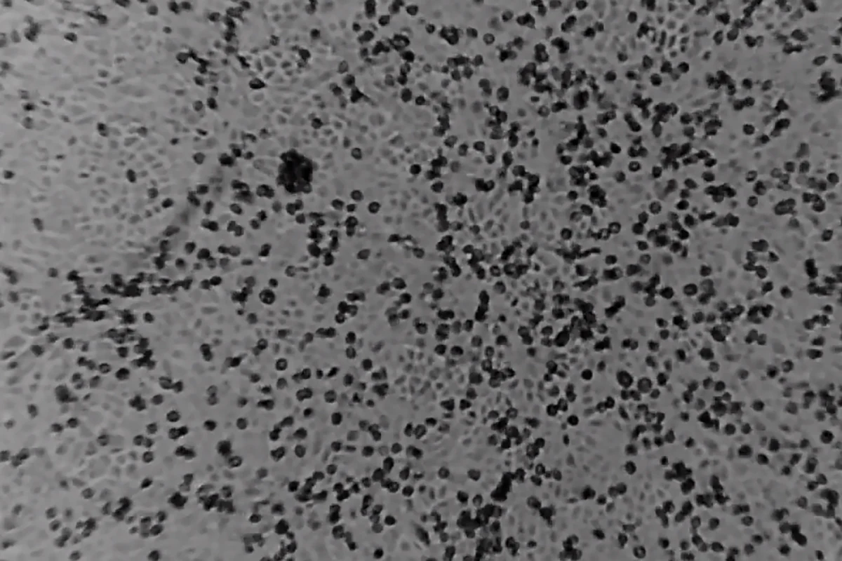 W czwartek do Polski dotrą primery umożliwiające sprawdzanie, czy osoba badana jest lub nie jest zarażona koronawirusem. Obecnie próbki do badań pobierane w Polsce wysyłane są do laboratoriów za granicą. W Chinach potwierdzono 5974 zarażenia nowym koronawirusem 2019-nCoV oraz 132 spowodowane nim zgony. Jego przypadki potwierdzono w 16 innych państwach, w tym dwóch europejskich - we Francji i w Niemczech.