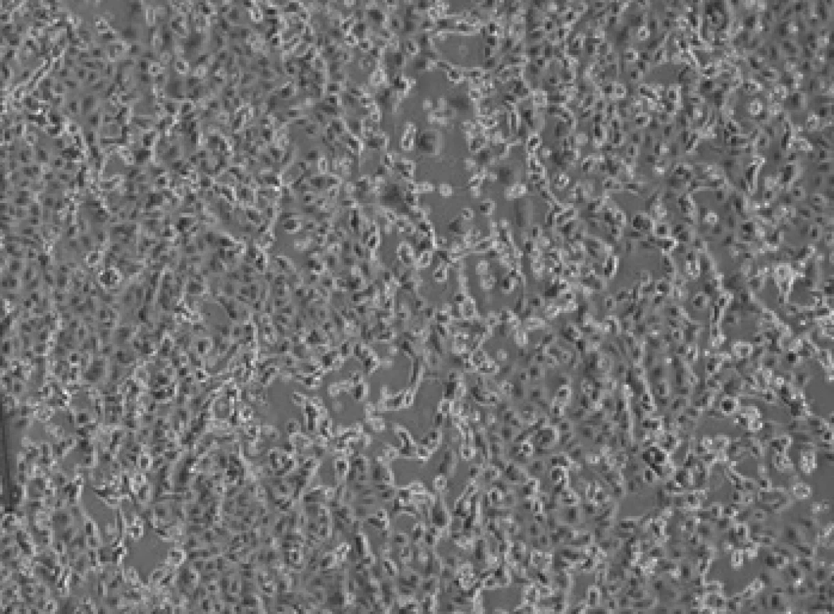 W rzymskim szpitalu zakaźnym został wyizolowany koronawirus - ogłosił włoski minister zdrowia Roberto Speranza. Na konferencji prasowej podkreślił, że to wiadomość o znaczeniu "globalnym". Włochy to pierwszy kraj w Europie, w którym to się udało.