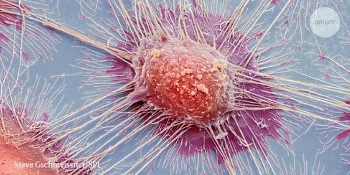 Rosną szanse na skuteczniejszą diagnostykę i terapię nowotworów. W tym tygodniu ogłoszono wyniki największych w historii badań genomów komórek nowotworowych. Tygodnik "Nature" i inne czasopisma opublikowały w sumie 22 artykuły na ten temat, dzieło 1300 naukowców z 37 krajów, którzy brali udział w projekcie Pan-Cancer. Przeanalizowali oni 2600 genomów komórek aż 38 typów nowotworów. Wskazali na mutacje DNA, które prowadzą do pojawienia się choroby, pozwalają też ocenić, jaka była ich bezpośrednia przyczyna, choćby wystawianie się na promieniowanie UV, czy palenie papierosów. Dzięki tej pracy łatwiej będzie teraz analizować przyczyny nowotworów, diagnozować je i leczyć. Łatwiejsza powinna być profilaktyka, łatwiejsze ustalenie, dlaczego ten sam rodzaj raka u jednych pacjentów da się w dany sposób leczyć, a u innych nie. Onkologia zyskała potężne źródło informacji, które teraz musi wykorzystać.