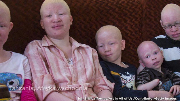 Są prześladowani, mordowani i okaleczani z powodu zabobonnej wiary. Albinosi w Tanzanii muszą się ukrywać i żyją w ciągłym strachu. Wiara w czarną magię oraz brak edukacji na ten temat jest dla albinosów często wyrokiem śmierci lub kalectwa. Miejscowi nazywają ich „białymi duchami” i wierzą, że mają oni niezwykłą moc, a ich ciała uzdrawiają...