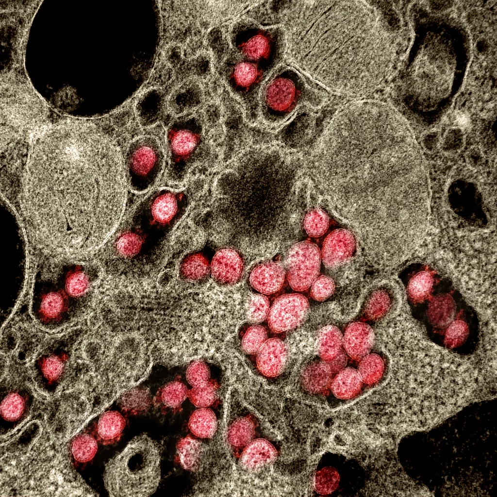 Koronawirus. Zdjęcie wykonane z pomocą transmisyjnego mikrografu elektronowego.