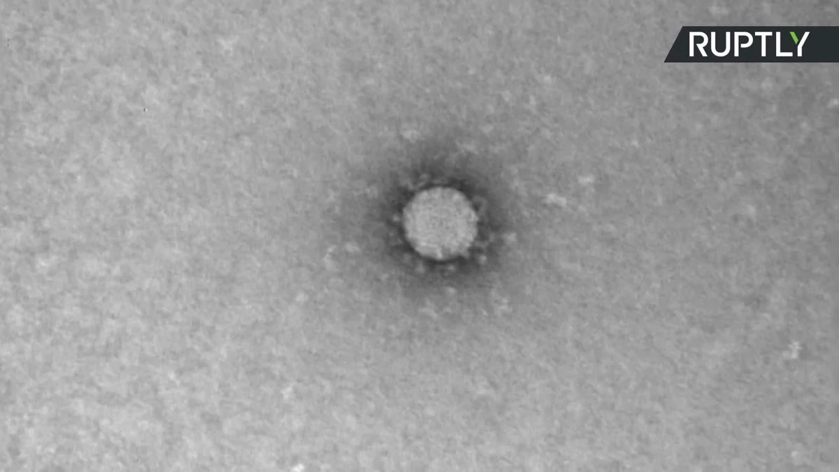 Naukowcy z rosyjskiego Instytutu Vector w Nowosybirsku opublikowali mikroskopowe zdjęcia koronawirusa. Jak poinformowali, są to pierwsze takie fotografie. Do ich wykonania użyto mikroskopu elektronowego JEM-1400, a wielkość cząsteczek wirusa oszacowano na 100 do 120 nanometrów.