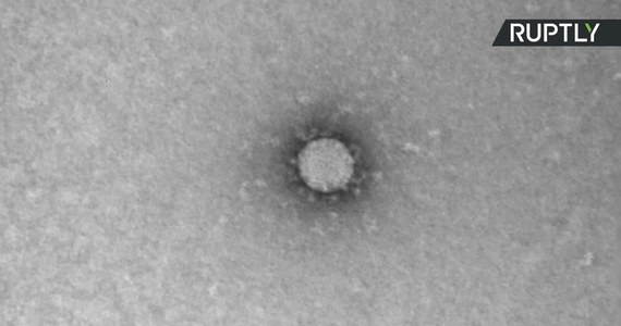 Naukowcy z rosyjskiego Instytutu Vector w Nowosybirsku opublikowali mikroskopowe zdjęcia koronawirusa. Jak poinformowali, są to pierwsze takie fotografie. Do ich wykonania użyto mikroskopu elektronowego JEM-1400, a wielkość cząsteczek wirusa oszacowano na 100 do 120 nanometrów.