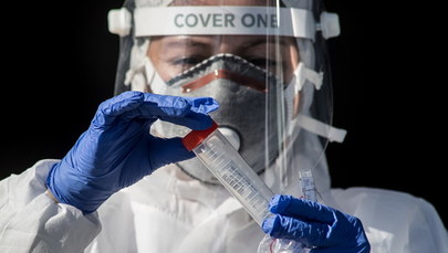 Resort i NFZ obniżają stawki: Laboratoria dostaną mniej pieniędzy za wykonywanie testów na koronawirusa