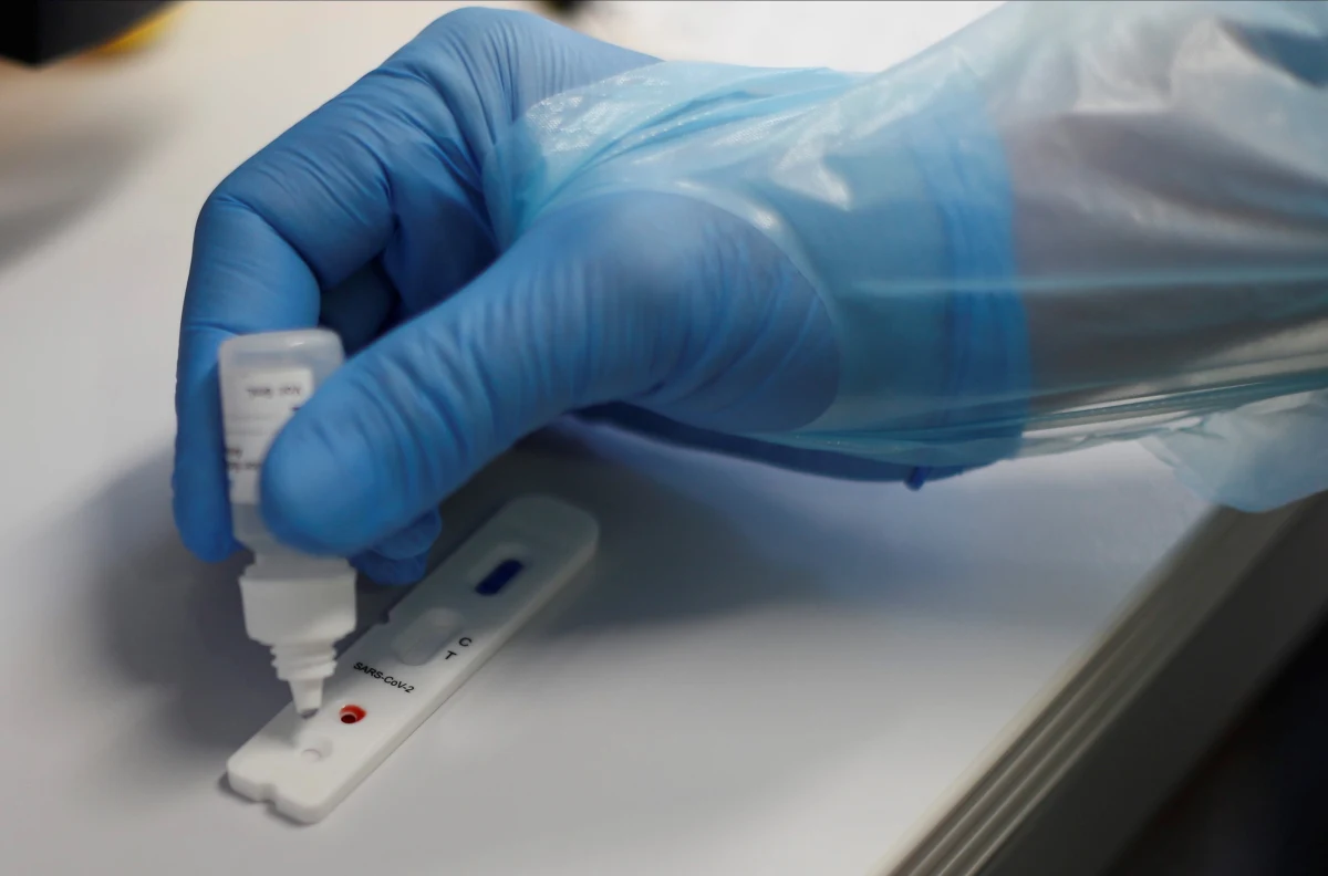 Eksperci są zgodni - w zapobieganiu rozprzestrzeniania się koronawirusa szczególnie istotna jest jego diagnostyka. Liczba przeprowadzonych testów znacząco wpływa nie tylko na wykrywalność, ale również pozwala skutecznie izolować zakażonych i ograniczyć liczbę nowych zachorowań. Obecnie w diagnostyce koronawirusa wykorzystywane są testy antygenowe, molekularne i serologiczne. Jak działają i czym się różnią? Który jest najszybszy i najskuteczniejszy?