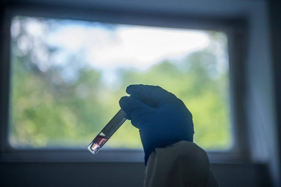 /ZOLTAN BALOGH /PAP/EPA