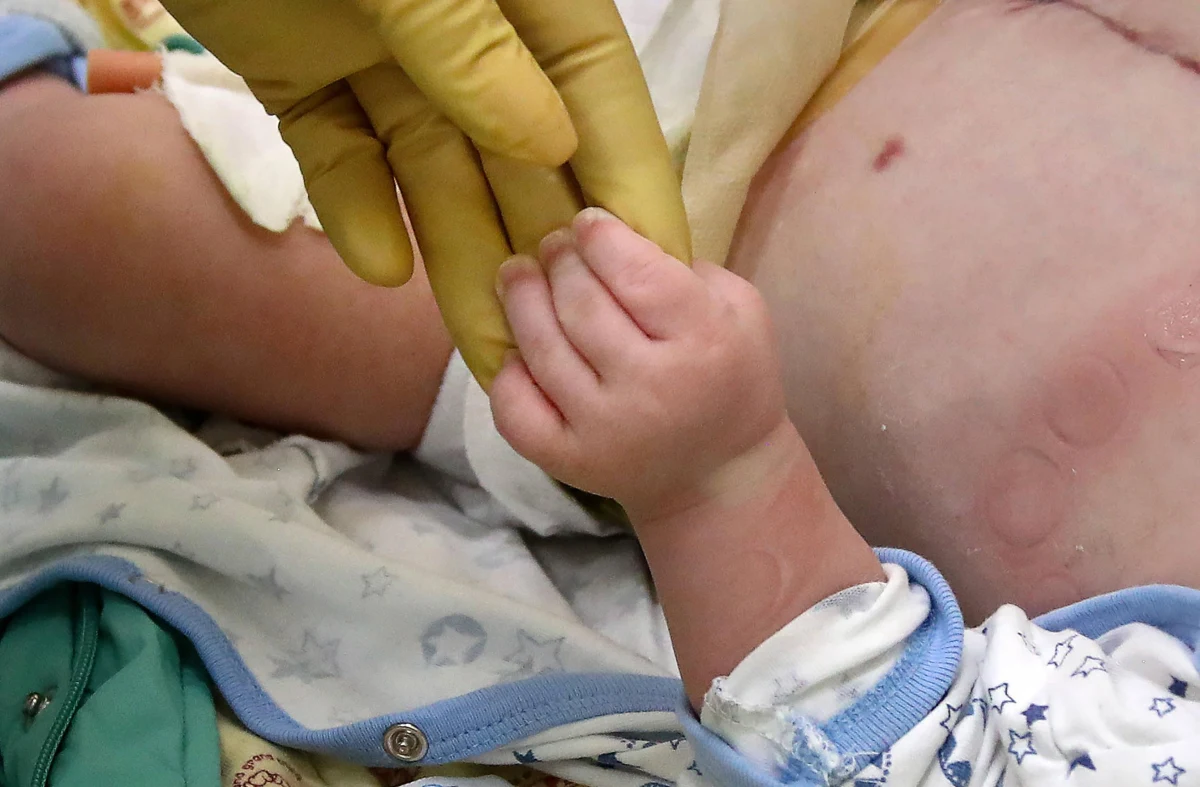 Po przyjęciu do szpitali grupy dzieci z objawami rzadkiego schorzenia, które może mieć związek z Covid-19, władze Nowego Jorku ogłosiły alert zdrowotny. Tzw. choroba Kawasakiego zagraża życiu małych pacjentów.