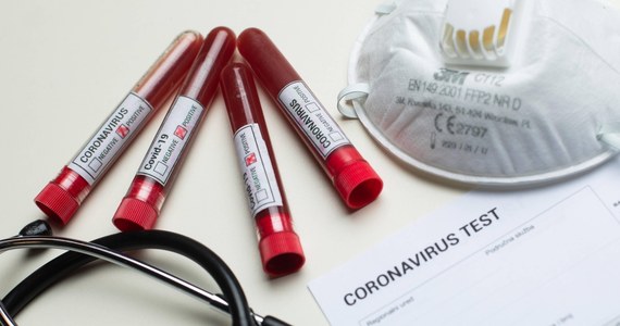 44 lekarzy zmarło w Hiszpanii w wyniku zachorowania na Covid-19 – poinfromowała tamtejsza Izba Lekarska. W statystyce uwzględniono tylko zgony medyków, u których potwierdzono wcześniej infekcję koronawirusem.