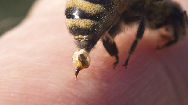 Użądlenie przez pszczołę, osę, szerszenia czy trzmiela jest bolesne, a w skrajnych przypadkach, gdy owad ukąsi w okolicę ust, gardła lub języka, bywa niebezpieczne. Bardzo uważać muszą także osoby uczulone na jad, bo nawet jedno użądlenie może spowodować wstrząs anafilaktyczny. 