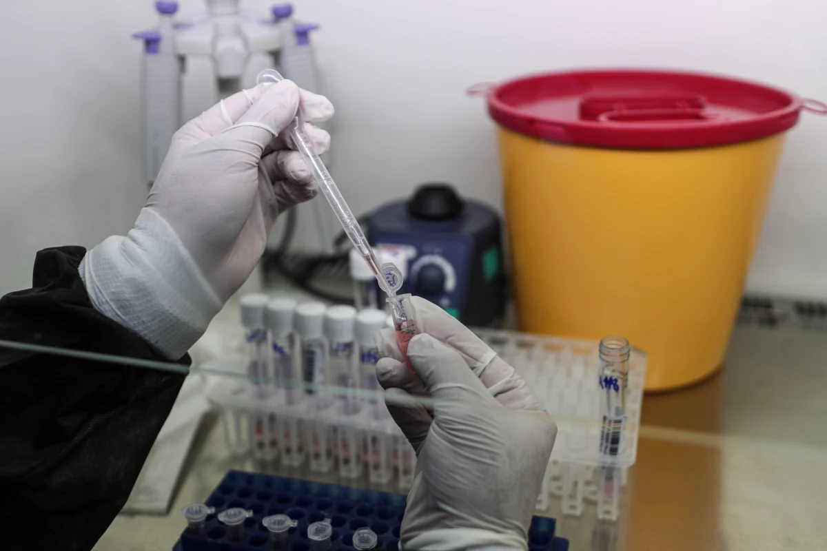 Szpital CSK MSWiA rozpoczyna program testowania nowego leku u pacjentów zakażonych koronawirusem. Nadzieje są duże, ponieważ w badaniach wykazano, że czas pobytu w szpitalu pacjenta zakażonego SARS-CoV-2 uległ skróceniu aż o 30 proc. – mówi PAP dr Rafał Wójtowicz z CSK MSWiA.