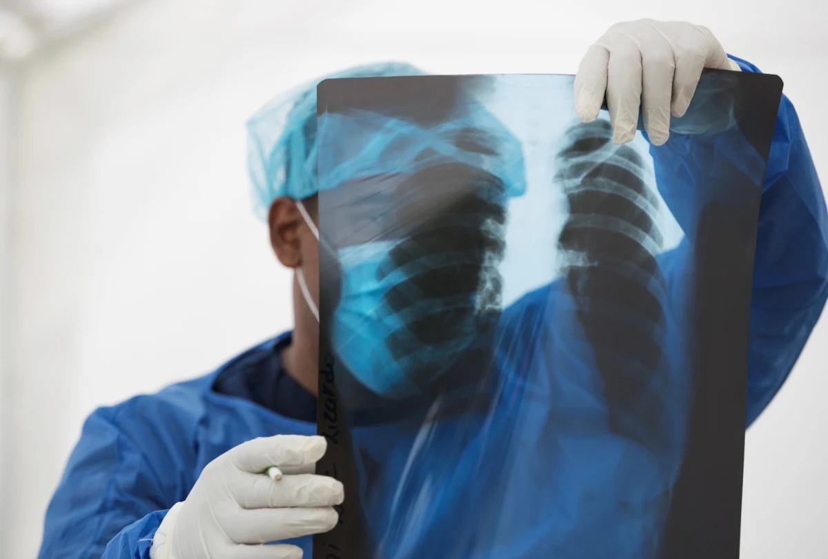 W czwartek Ministerstwo Zdrowia poinformowało o nowych 314 potwierdzonych przypadkach zakażenia koronawirusem i kolejnych 30 zgonach. Aktualny bilans epidemii w Polsce to 31 015 zakażeń i 1 316 zgonów. Od początku epidemii w całym kraju wyzdrowiało już 15 317 osób.