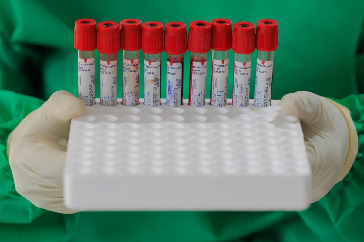 Dwóch kapłanów, mieszkających ostatnio w Domu Księży Seniorów w Radomiu, zmarło na COVID-19 w miejscowym szpitalu – przekazał kanclerz Kurii Biskupiej w Radomiu ks. prał. Edward Poniewierski. Wcześniej na COVID-19 zmarł już jeden ksiądz z tego domu.