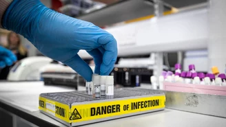 Wielka Brytania: Niebezpieczne incydenty w laboratoriach. Rozlane próbki z koronawirusem