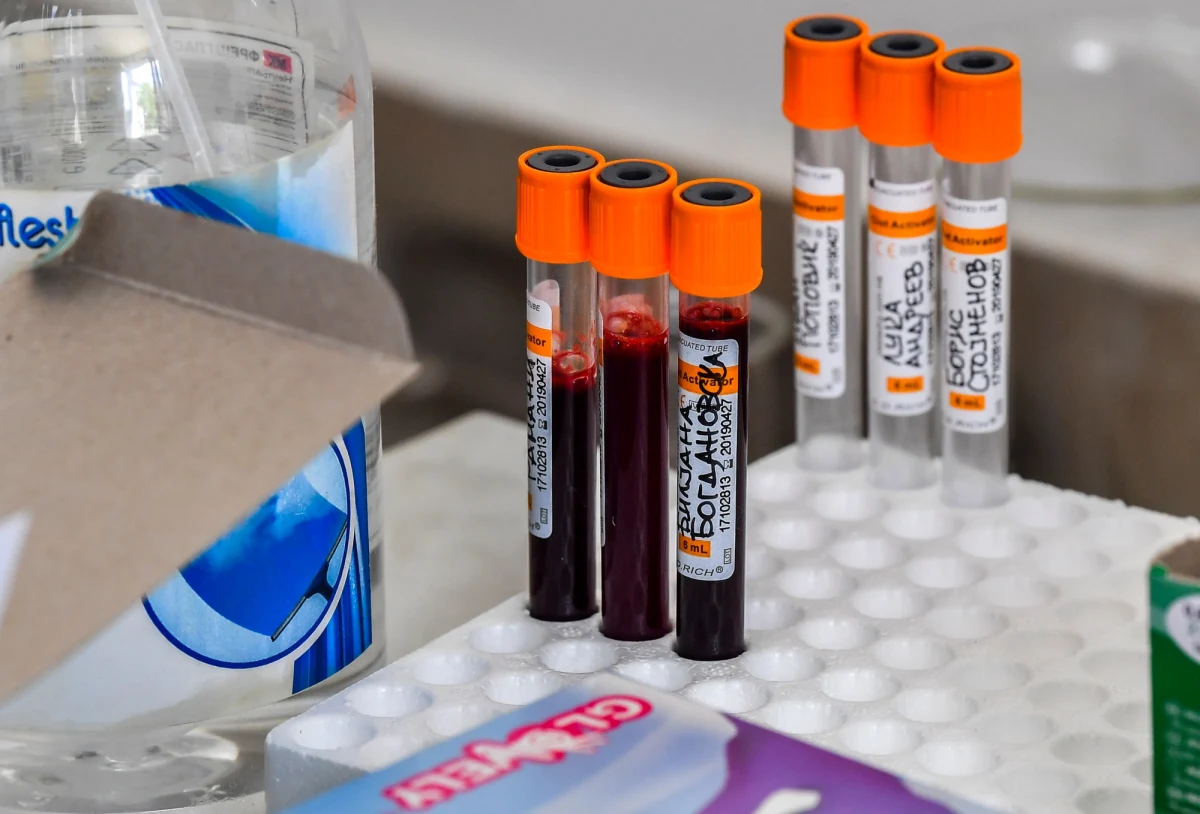 Jedne z najsilniejszych jak dotąd przeciwciał, neutralizujących koronawirusa SARS-CoV-2, wyizolowano od pacjentów, którzy przebyli COVID-19 – wyniki badań opublikowano na łamach czasopisma „Nature”. Mogą one pomóc zarówno w leczeniu, jak i zapobieganiu infekcji.