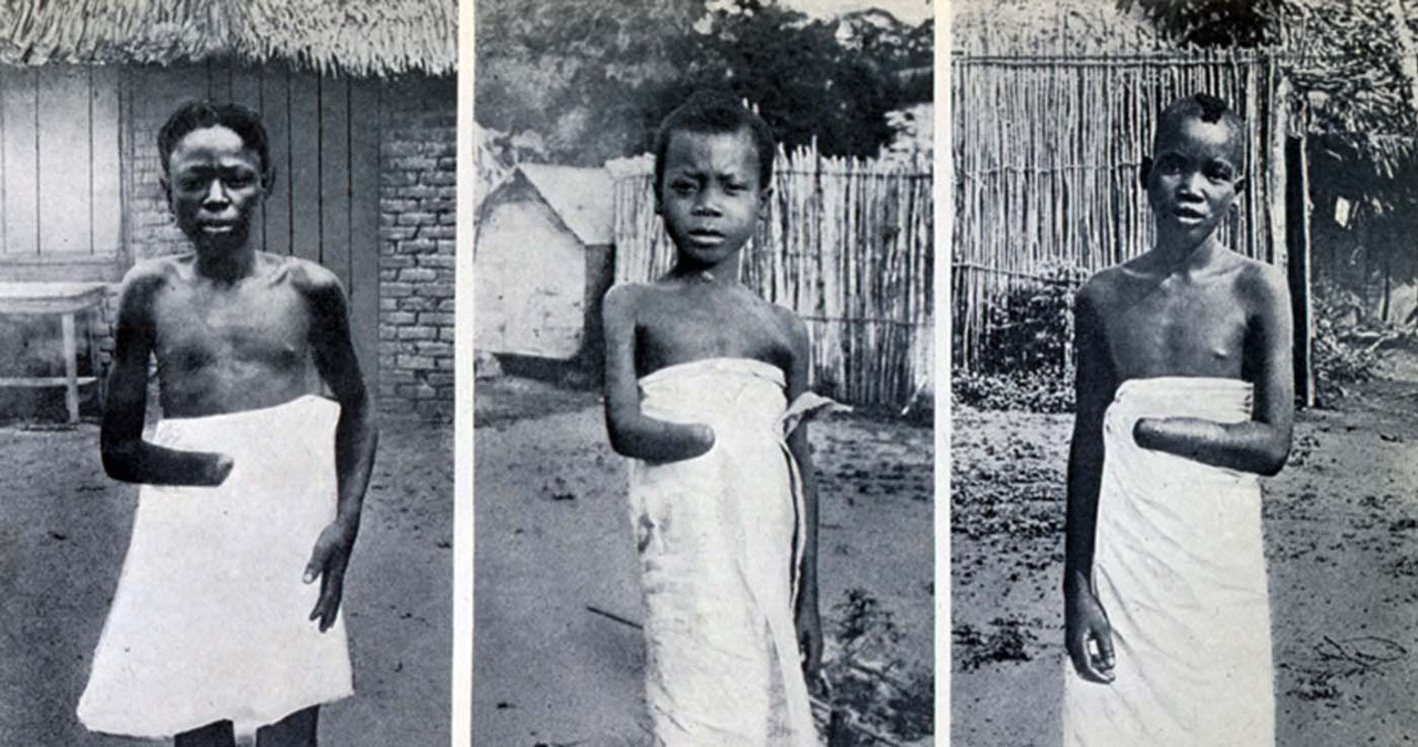 Belgijskie Kongo. Okrucieństwo, o którym zapomniał świat Geekweek w INTERIA.PL