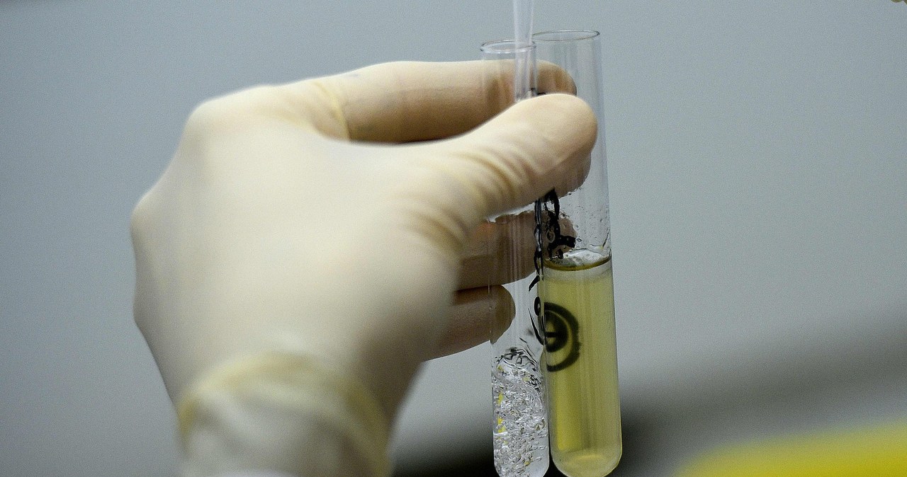 Niecodzienna sytuacja. Osiem zawodniczek oblało testy antydopingowe