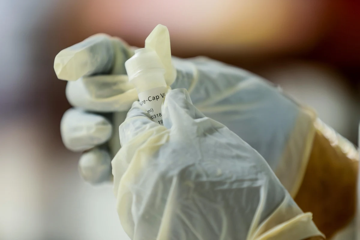 33-latek, u którego cztery miesiące po wyleczeniu z Covid-19 znów wykryto koronawirusa, najpewniej zakaził się ponownie podczas podróży do Hiszpanii – ocenił mikrobiolog z Uniwersytetu Hongkongu Yuen Kwok-yung.