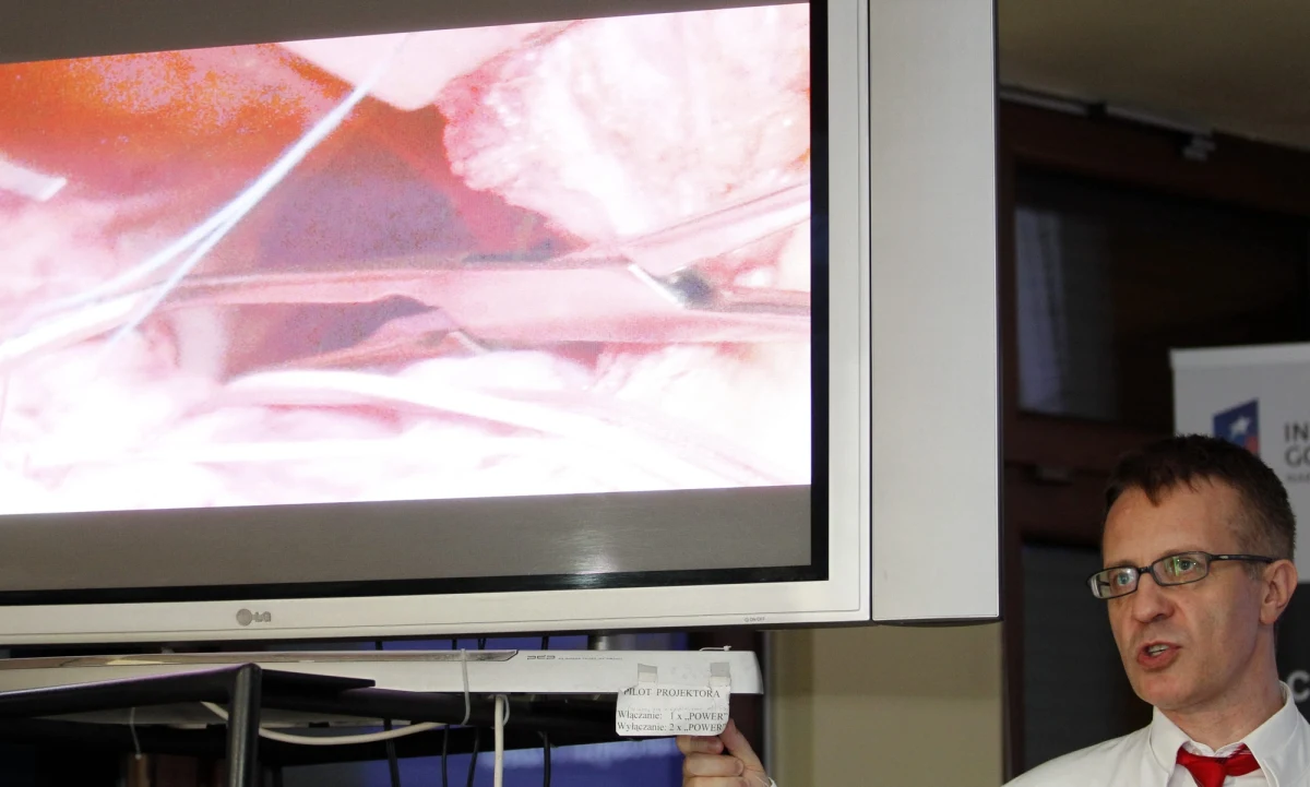 W Uniwersyteckim Centrum Klinicznym w Gdańsku przeszczepiono płuca 70-letniemu byłemu sportowcowi cierpiącemu na zwłóknienie tego narządu. Centrum podaje, że jest to najstarszy w Polsce pacjent, u którego wykonano taki zabieg.
