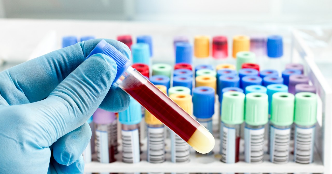 Rewolucyjne badanie krwi. Wykrywa rzadkie choroby genetyczne