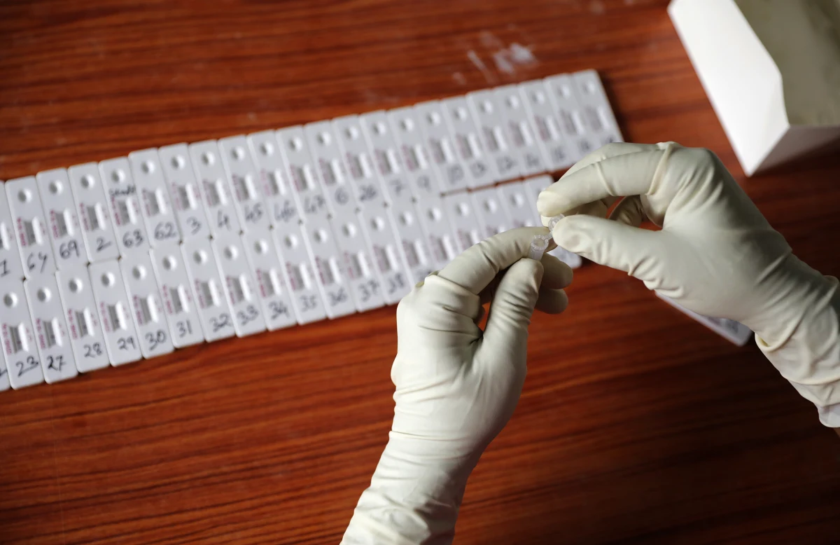 Naukowcy z Instytutu Chemii Bioorganicznej Polskiej Akademii Nauk w Poznaniu (IChB PAN) opracowali nową wersję testu na obecność SARS-CoV-2. Jest ona dwa razy szybsza od ostatniej generacji.