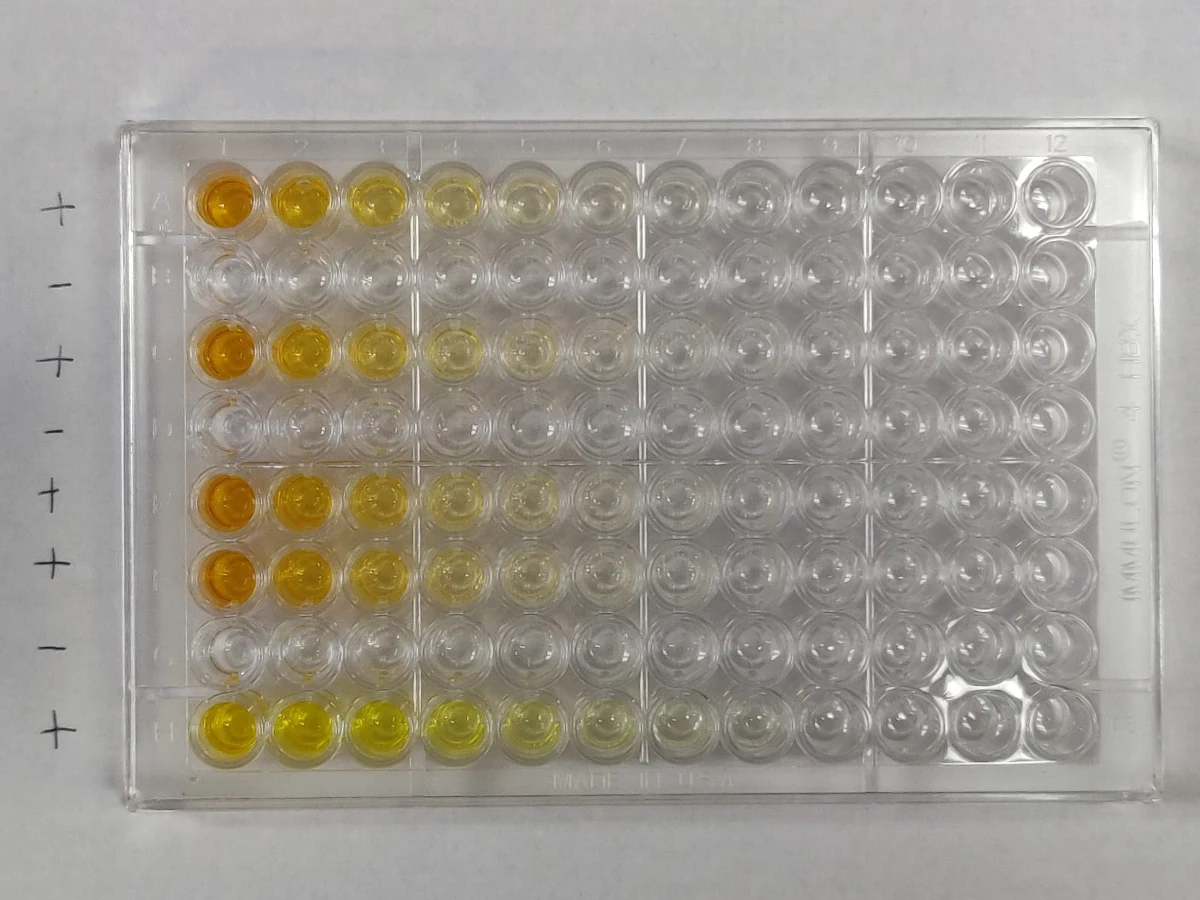 Kolejne wyniki badań potwierdzają, że przeciwciałą SARS-Cov-2 utrzymują się w organizmie osób, które przeszły zakażenie koronawirusem przez co najmniej kilka miesięcy. Piszą o tym na łamach czasopisma "Science" naukowcy Icahn School of Medicine przy Szpitalu Mount Sinai w Nowym Jorku. Badania przypadków około 30 tysięcy osób który przeszły zakażenie łagodnie i umiarkownie wykazały stabilny poziom przeciwciał przez co najmniej 5 miesięcy.