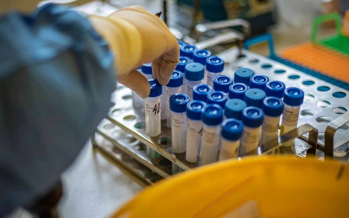 Bez "sejsmicznej zmiany" we wspólnej batalii z chorobami zakaźnymi kolejne pandemie będą nawiedzać świat częściej, rozprzestrzeniać się szybciej, mocniej szkodzić gospodarce i zabijać więcej ludzi niż Covid-19 - ostrzegają międzynarodowi eksperci na forum ONZ.