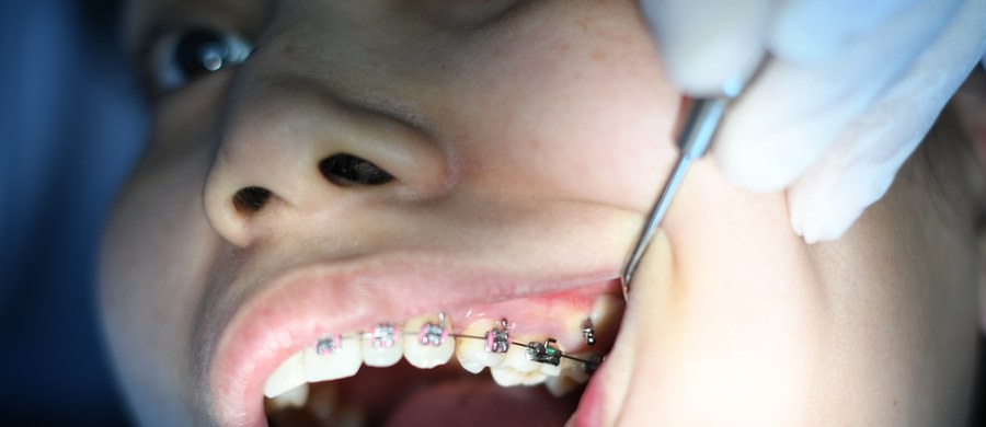 Według Światowej Organizacji Zdrowia wady zgryzu są trzecim, po próchnicy i chorobach przyzębia, najbardziej rozpowszechnionym problemem zdrowotnym jamy ustnej. „Badania pokazują, że z ich powodu cierpi ponad 90% Polaków, a co drugi z nich powinien być leczony ortodontycznie. Nie wszystkie wady zgryzu mogą jednak zostać wyleczone przez ortodontę. Coraz więcej przypadków trafia do chirurgów twarzowo-szczękowych” - mówi chirurg szczękowo-twarzowy dr n. med. Rafał Nowak. 