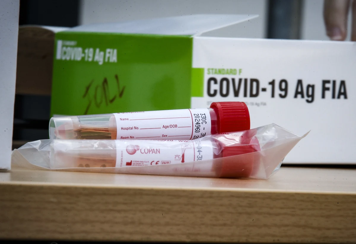 Szybkie testy antygenowe będą wykorzystywane do stwierdzania zakażenia koronawirusem SARS-CoV-2 obok testów PCR. Mają pomóc m.in. w szybszej diagnostyce pacjentów na SOR-ach czy w innych placówkach ochrony zdrowia.