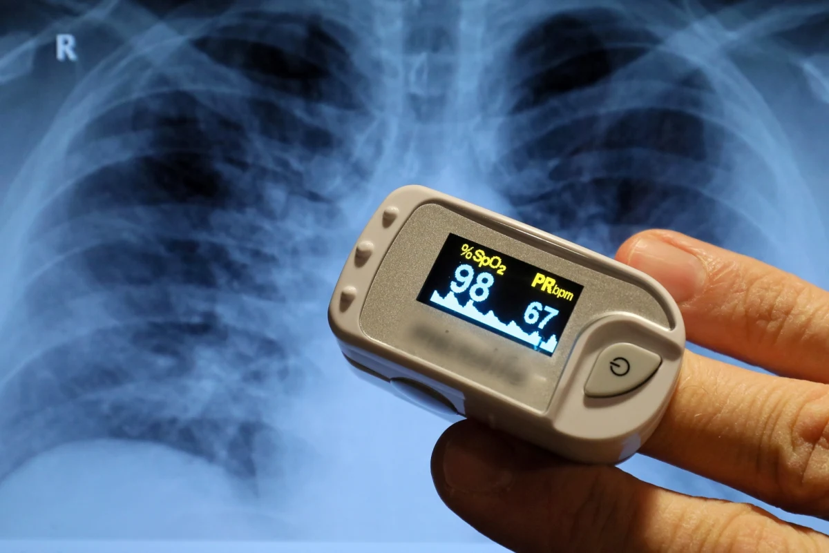 Triaż, triaż i jeszcze raz triaż - trzeba jak najszybciej skutecznie segregować chorych, zanim trafią do szpitali, bo bez tego każda pula nowych łóżek natychmiast się wyczerpie. Tak w rozmowie z reporterem RMF mówi Waldemar Malinowski, prezes Związku Pracodawców Szpitali Powiatowych. Apeluje też, by państwo dofinansowało zakup pulsoksymetrów dla Polaków. 