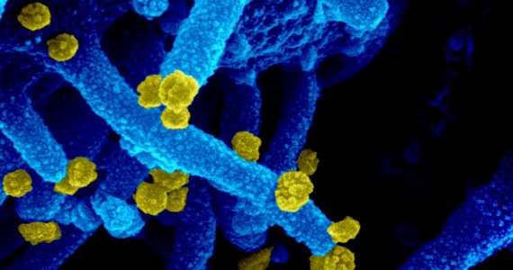 Wirus SARS-Cov-2 nie przestaje zadziwiać. Na łamach czasopisma "Cell" naukowcy z National Institute of Allergy and Infectious Diseases opisują przypadek pacjentki, u której zakażenie koronawirusem trwało aż 105 dni. Przez 70 dni mogła przy tym zakażać innych, bo w jej układzie oddechowym wirusa wciąż było dużo. Pacjentka jest chora na białaczkę, w jej organizmie pojawiło się bardzo mało przeciwciał i przez cały czas infekcji nie miała żadnych objawów.