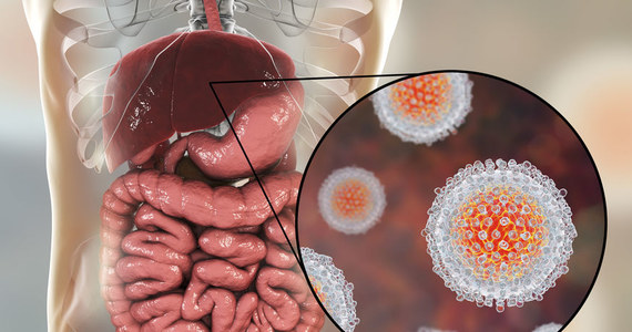 Wirusowe Zapalenie Wątroby Typu C: Przyczyny, Objawy I Leczenie ...