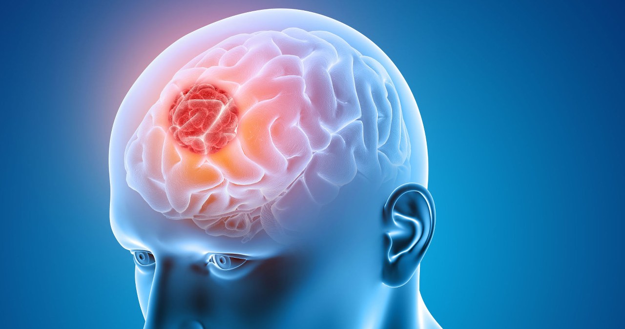 Komórki odpornościowe robią coś dziwnego, aby powstrzymać pasożyta mózgu