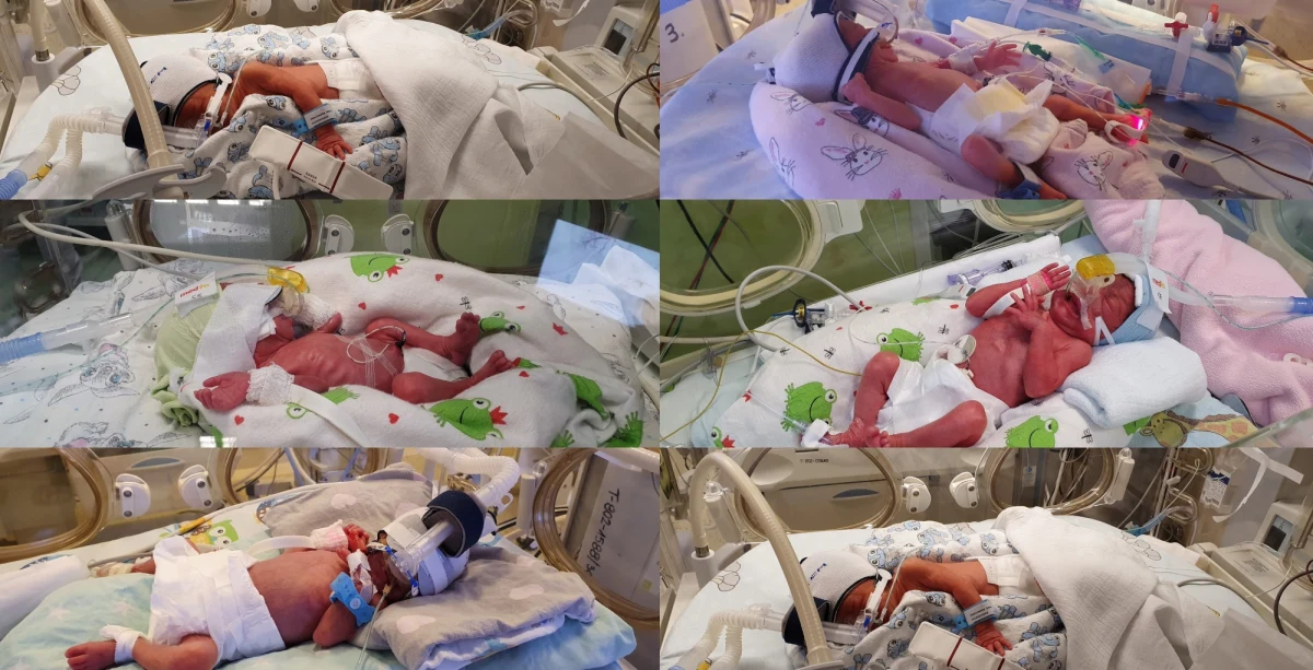 "Urodzone w poznańskiej klinice pięcioraczki czują się dobrze, ich stan nadal określany jest jako stabilny" – powiedział rzecznik Ginekologiczno-Położniczego Szpitala Klinicznego Uniwersytetu Medycznego im. K. Marcinkowskiego w Poznaniu Lesław Ciesiółka.