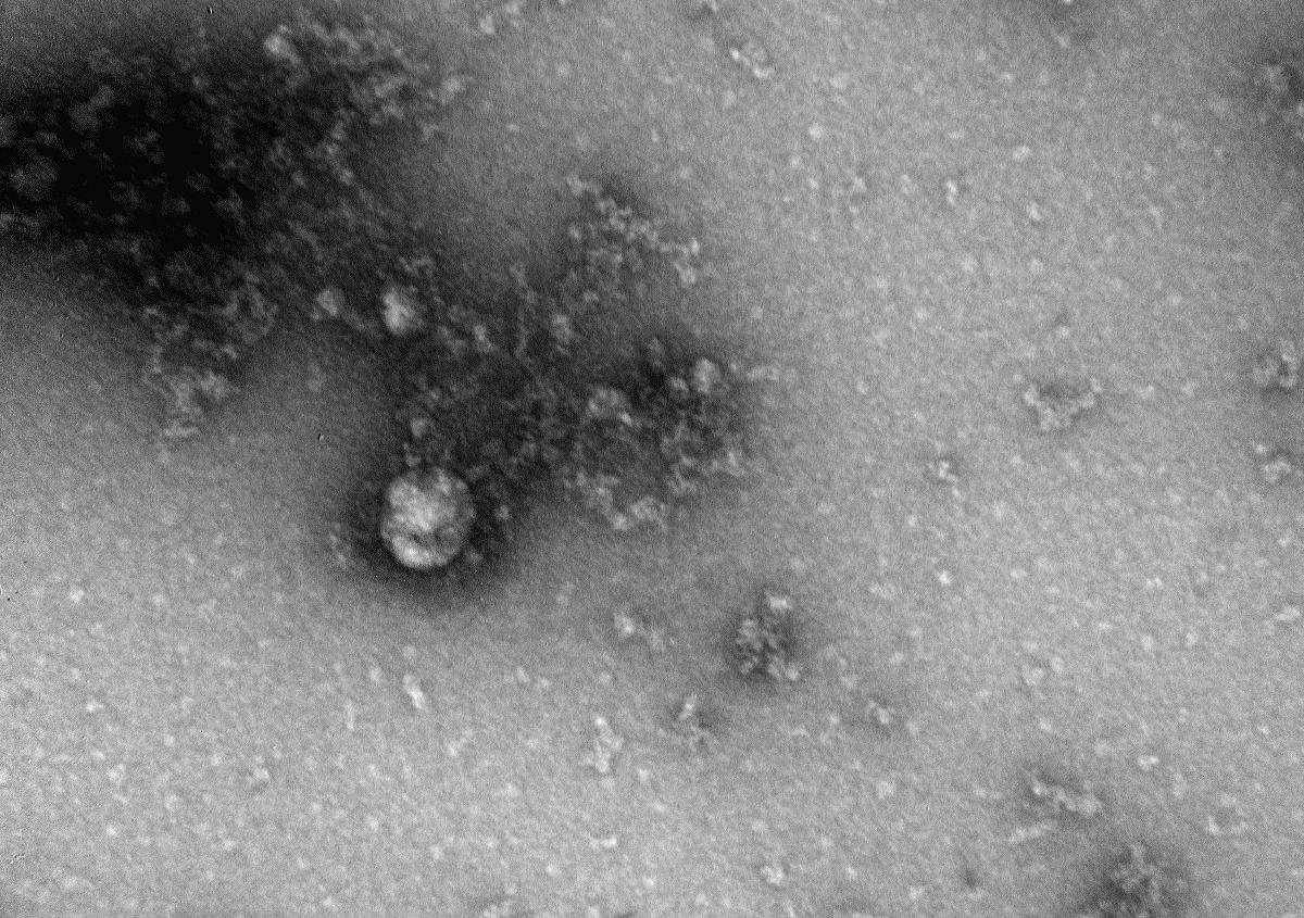 ​Drugi przypadek mutacji brytyjskiej koronawirusa w Polsce został wykryty w ramach badania przesiewowego nauczycieli i dotyczy jednej z nauczycielek we Wrocławiu - poinformował szef resortu zdrowia Adam Niedzielski.