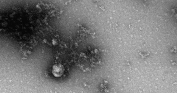 ​Drugi przypadek mutacji brytyjskiej koronawirusa w Polsce został wykryty w ramach badania przesiewowego nauczycieli i dotyczy jednej z nauczycielek we Wrocławiu - poinformował szef resortu zdrowia Adam Niedzielski.