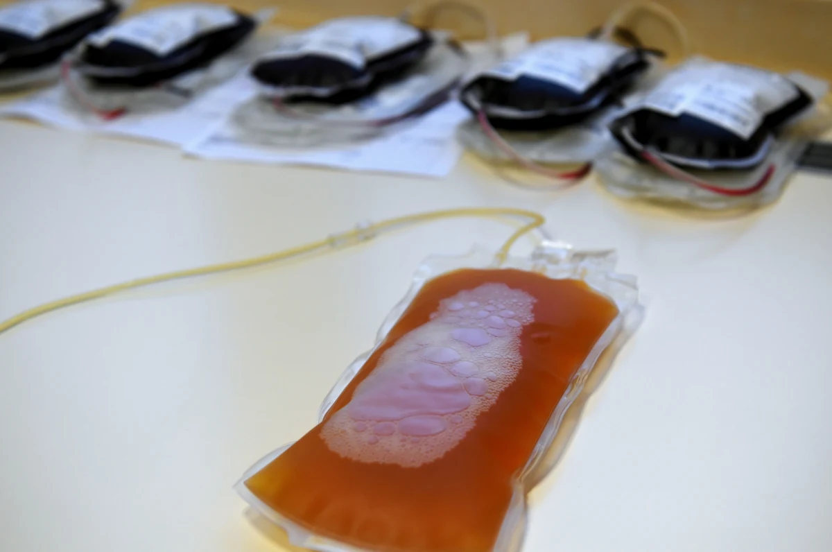 Osoba po 30-tce, która ciężko przeszła zakażenie koronawirusem, nie później niż 60 dni od pojawienia się pierwszych objawów - to zdaniem naukowców Pennsylvania State University idealny dawca osocza, które może pomóc kolejnym chorym na Covid-19. Jak pisze w najnowszym numerze czasopismo "Communications Biology" wyniki badań wskazują, że plazma od osób spełniających te warunki zawiera najwięcej korzystnych w walce z koronawirusem przeciwciał. 