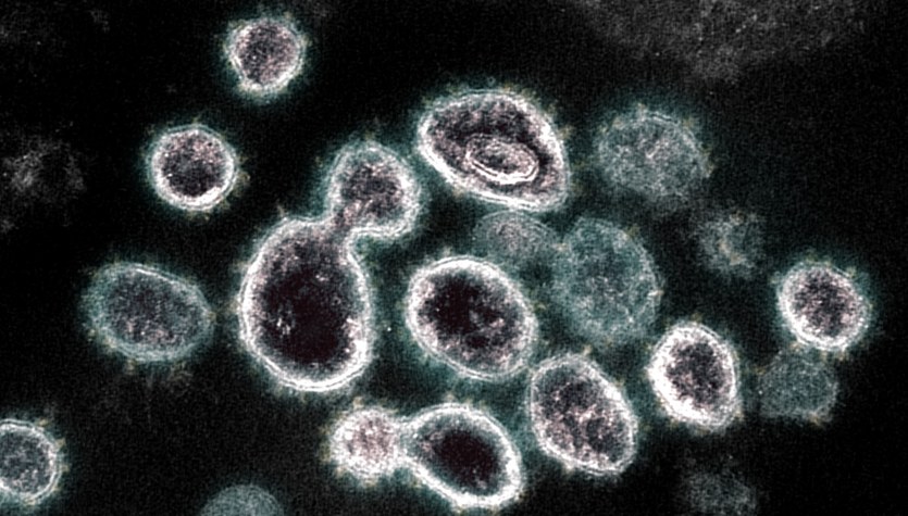Coronavirus.  Se han identificado nuevas subvariantes resistentes a la vacuna en los Estados Unidos y Australia