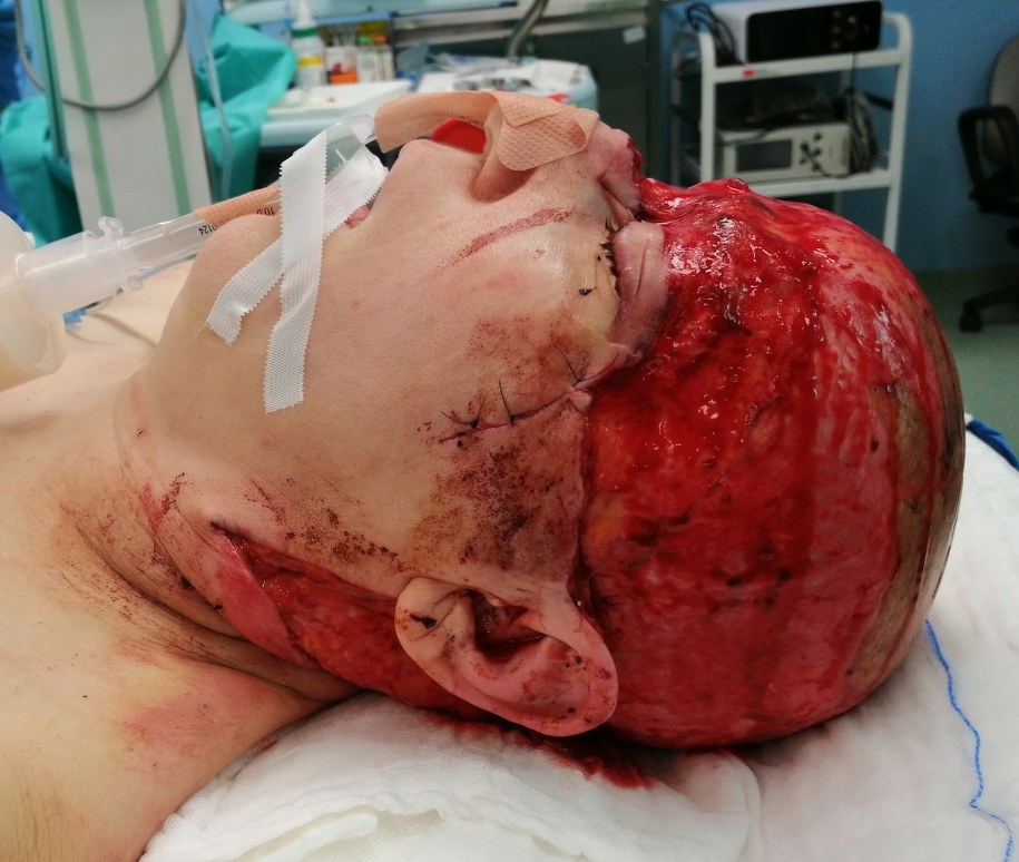 /fot.: Narodowy Instytut Onkologii w Gliwicach /