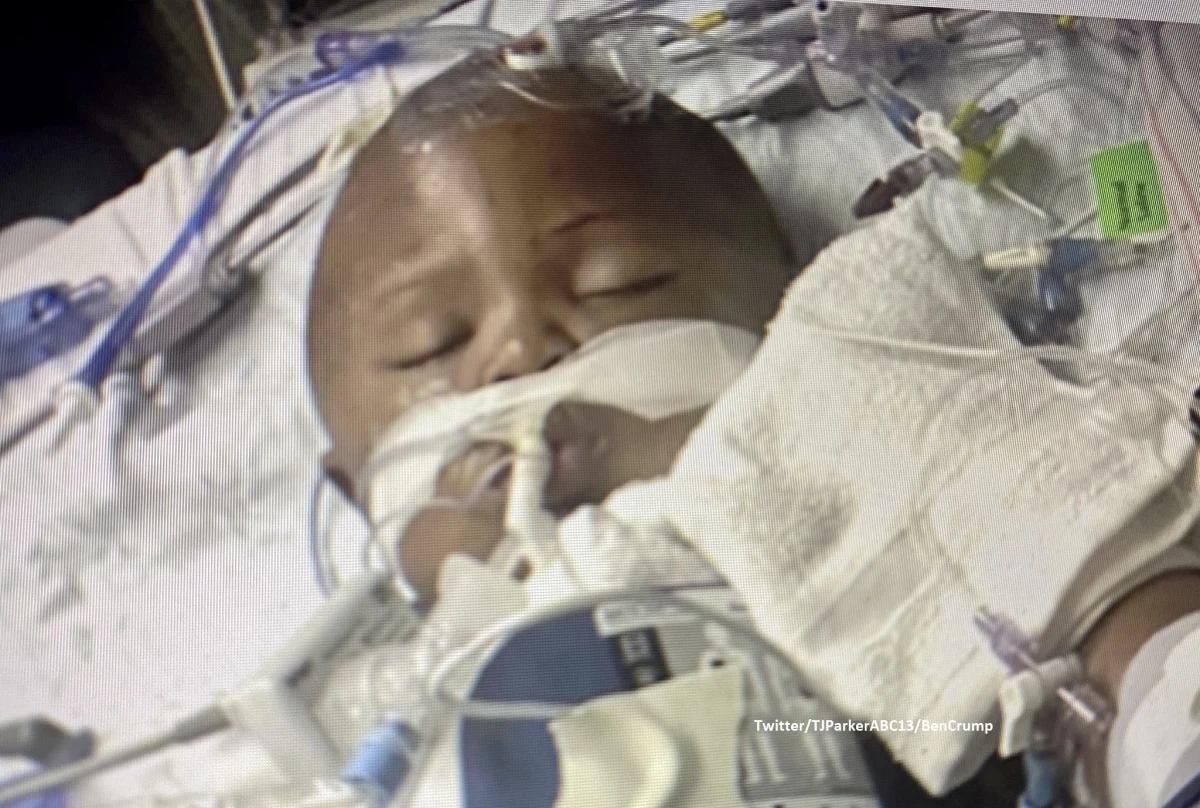 Policja w Houston w amerykańskim stanie Teksas postrzeliła roczne dziecko w głowę w trakcie operacji mającą na celu schwytanie mężczyzny podejrzanego o dokonywanie rozbojów. Chłopiec "walczy o życie" - poinformowała we wtorek jego matka.