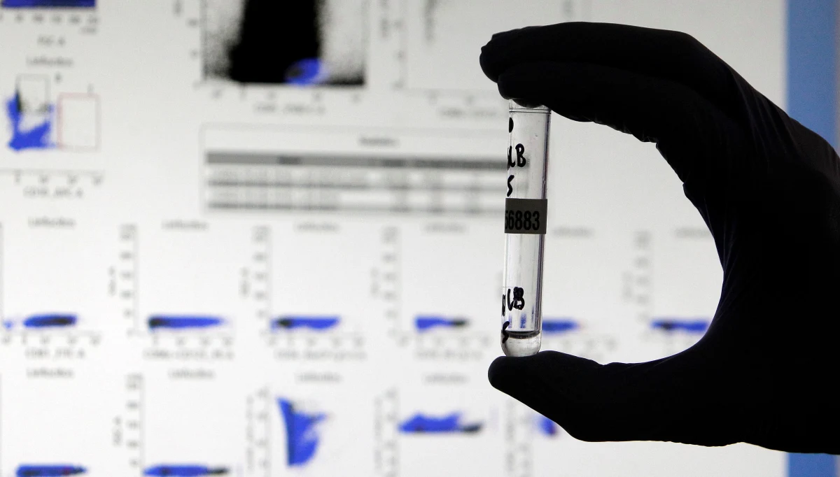 Światowa Organizacja Zdrowia (WHO) ogłosiła, że wprowadza nowe nazwy wariantów koronawirusa pochodzące od liter greckiego alfabetu. I tak wariant koronawirusa wykryty w Wielkiej Brytanii to Alfa, szczep kojarzony z RPA - Beta, wariant pochodzący z Brazylii - Gamma, a z Indii - Delta.