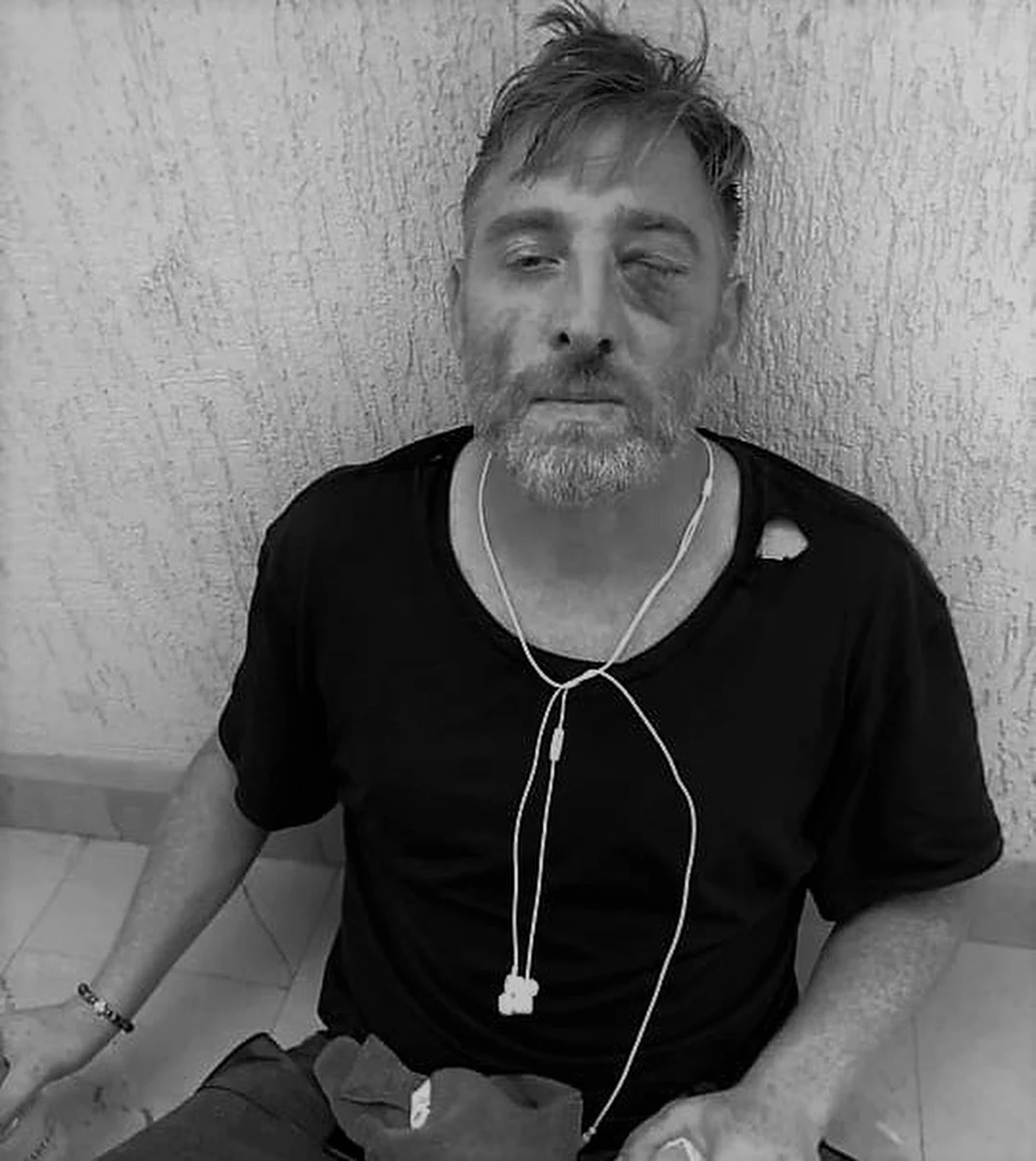 Nie żyje gruziński kamerzysta Aleksander Laszkarawa, który filmował 5 lipca protest przeciwników marszu równości w Tbilisi - podała telewizja Pirweli, dla której pracował kamerzysta. Mężczyzna został pobity przez skrajnie prawicowych demonstrantów.