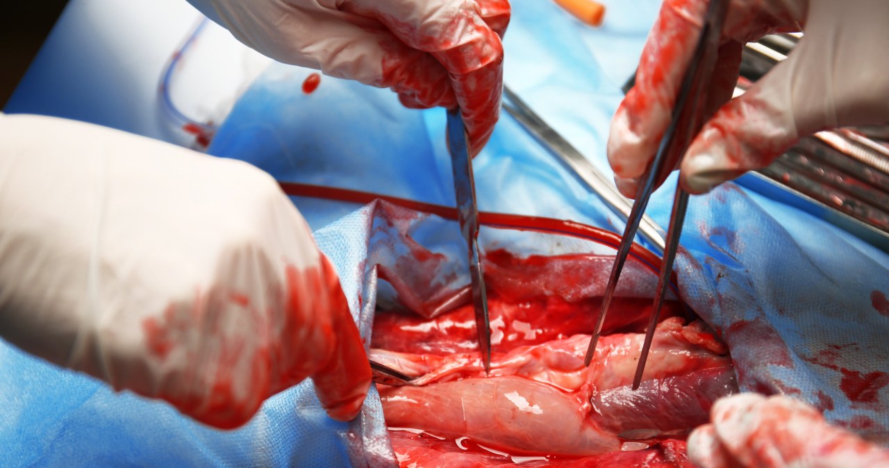 Ukraińscy lekarze wyciągają odłamki z serca... magnesem