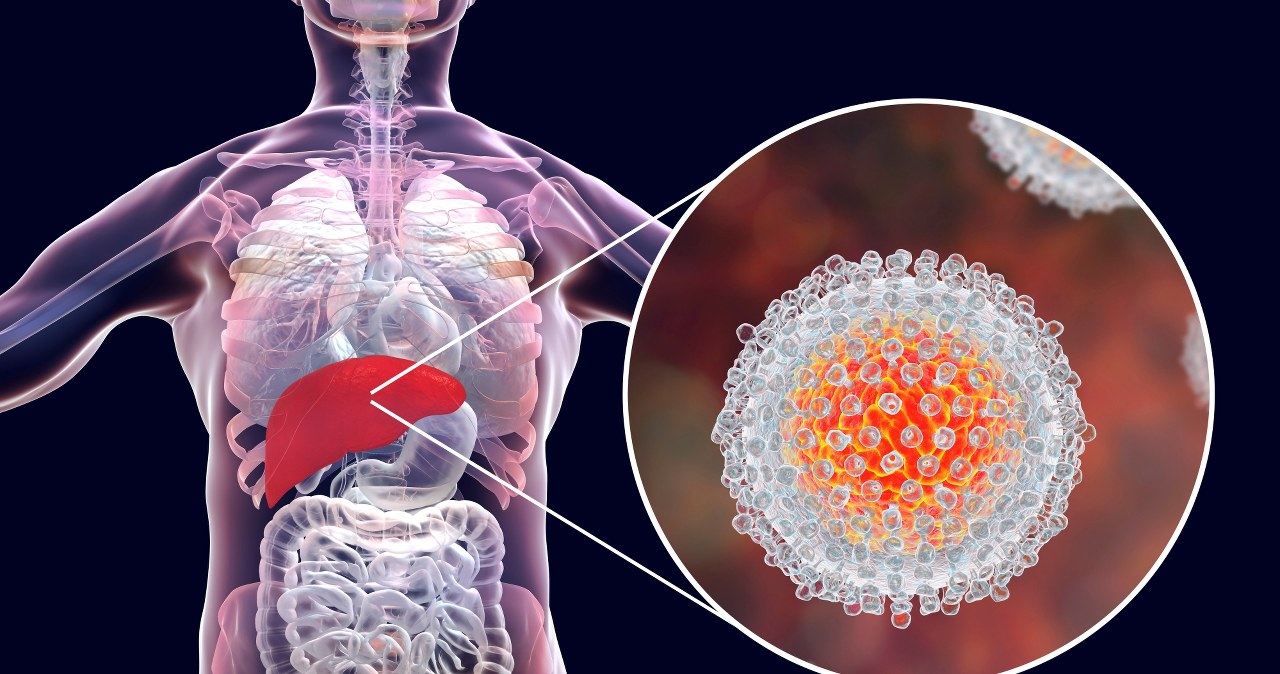 Nawet 150 tys. Polaków ma tego wirusa. Może wywołać schizofrenię