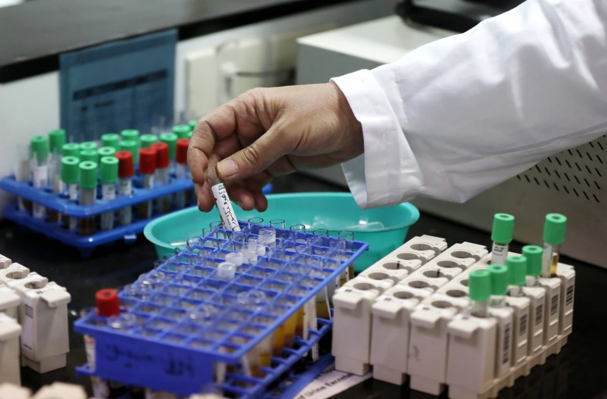 Izraelski lek na Covid-19 o nazwie EXO-CD24 przeszedł drugą fazę badań. Dzięki niemu wyzdrowiało 29 z 30 pacjentów w stanie od umiarkowanego do ciężkiego w ciągu maksymalnie 5 dni – donosi internetowe wydanie The Jerusalem Post.